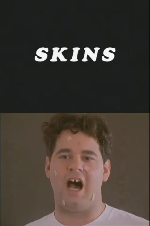 Skins poster